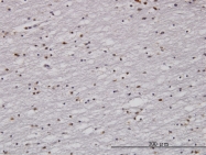 H00005810-M01 - RAD1