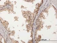 H00005819-B01P - CD112 / Nectin 2