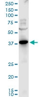 H00005828-A01 - Peroxin 2 / PEX2 / RNF72