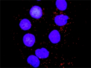 H00005829-D01P - Paxillin / PXN