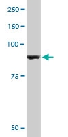 H00005837-M10 - Glycogen phosphorylase muscle form