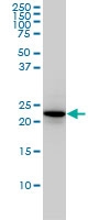 H00005867-M01 - RAB4A / RAB4