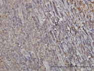 H00005870-M01 - RAB6A / RAB6