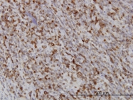 H00005873-M02 - RAB27A / RAB27