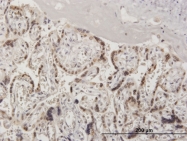 H00005905-B01 - RanGAP1