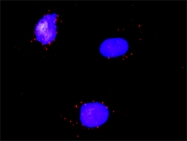 H00005914-M02 - RAR-alpha / RARA