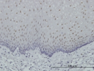 H00005914-M03 - RAR-alpha / RARA