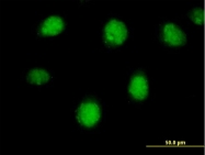 H00005915-B01P - RAR-beta / RARB
