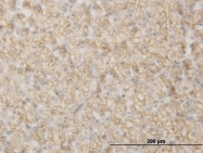 H00005950-M03 - RBP4