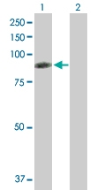 H00005962-B01P - Radixin / RDX