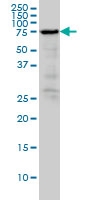 H00005962-M03 - Radixin / RDX