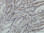 H00005998-M01 - RGS3