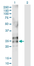 H00006036-D01P - RNASE2