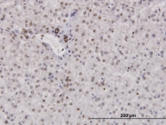 H00006118-B01 - RPA2