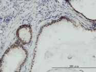 H00006119-M01 - RPA3 / RPA14