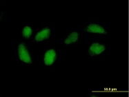 H00006120-B01 - RPE