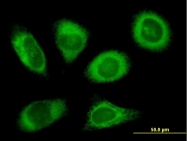 H00006185-B01P - Ribophorin-2 / RPN2