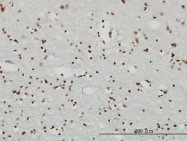 H00006196-M01 - RPS6KA2 / RSK3