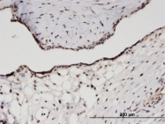 H00006205-M03 - RPS11