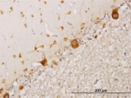 H00006218-M01 - RPS17