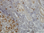 H00006241-M01 - RRM2 / RR2