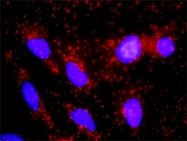 H00006256-D01P - RXR-alpha / RXRA