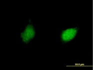 H00006258-B01 - RXR-gamma / RXRG