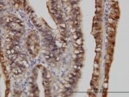 H00006277-M10 - S100A6 / Calcyclin