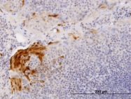 H00006278-B01P - S100A7 / Psoriasin