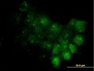 H00006278-M02 - S100A7 / Psoriasin