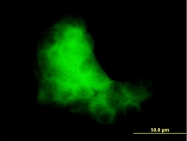 H00006278-M03 - S100A7 / Psoriasin