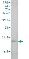 H00006288-M01 - Serum Amyloid A protein (SAA)