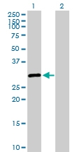 H00006297-D01P - Sal-like protein 2 (SALL2)