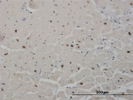 H00006297-M10 - Sal-like protein 2 (SALL2)