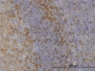 H00006300-M03 - MAPK12