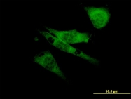 H00006334-M04 - SCN8A