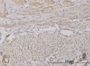 H00006374-M05 - CXCL5 / ENA78