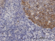 H00006375-M01 - XCL1 / Lymphotactin