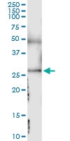 H00006385-D01 - Syndecan-4 (SDC4)