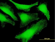 H00006386-B01P - Syntenin-1 / SDCBP