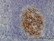 H00006386-M01 - Syntenin-1 / SDCBP