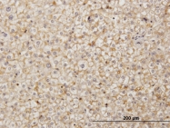 H00006388-M01 - SDF2