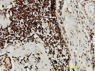 H00006446-M01 - SGK1 / SGK