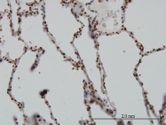 H00006446-M02 - SGK1 / SGK