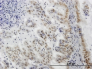 H00006446-M04 - SGK1 / SGK