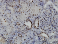H00006446-M05 - SGK1 / SGK