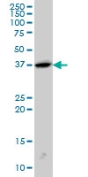 H00006456-M01 - Endophilin-A1