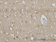 H00006456-M01 - Endophilin-A1