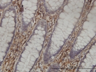 H00006470-M01 - SHMT1 / SHMT