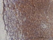 H00006483-M01 - ST3GAL2